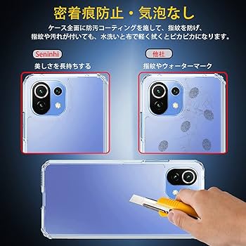 Xiaomi Mi 11 Lite 5G美品。純正ケース未使用、保護シート類多数 Xiaomi Mi 11 Lite 5G美品。純正ケース未使用、保護シート類多数